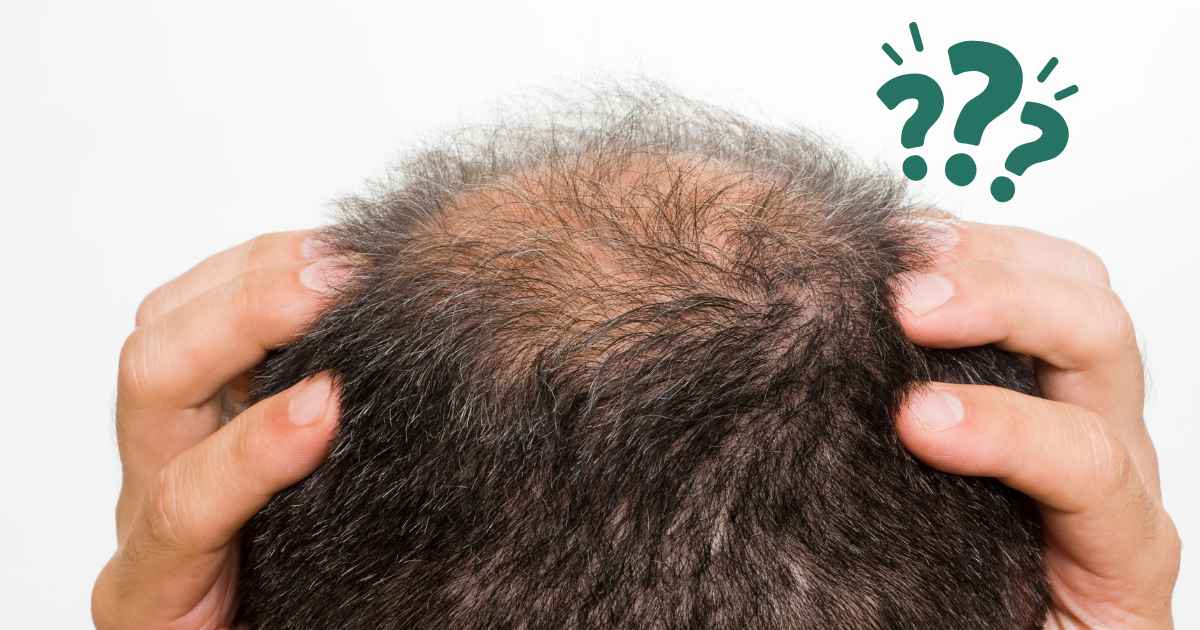 Vantaggi dell'impianto capillare, o patch cutaneo capillare